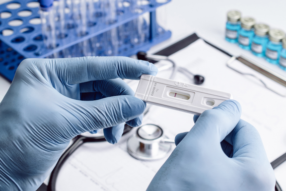 An antigen test kit for the coronavirus