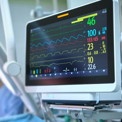 Heart rate and patient condition monitor in a hospital operating room The image shows a heart rate and patient condition monitor in a hospital operating room during a surgical procedure